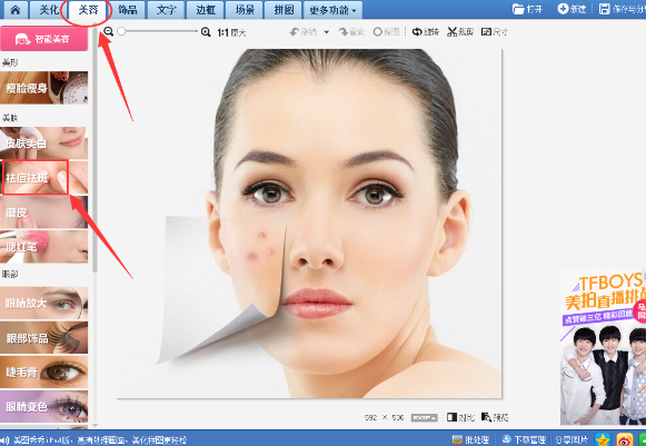 美圖秀秀怎么去除痘痘疤痕？美圖秀秀去除痘痘疤痕圖文教程