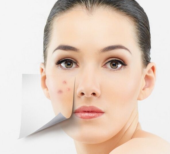 美圖秀秀怎么去除痘痘疤痕？美圖秀秀去除痘痘疤痕圖文教程