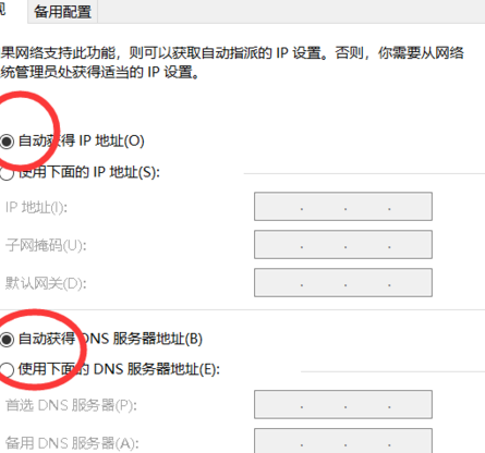 winxp系統中自動獲取ip地址具體操作方法