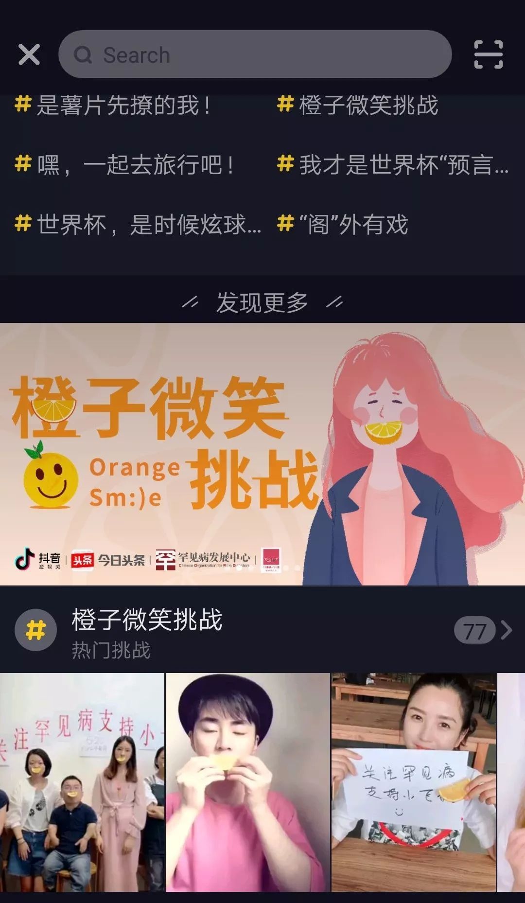 【抖音小飛俠是什么意思】小飛俠是什么病？橙子微笑挑戰(zhàn)如何參加