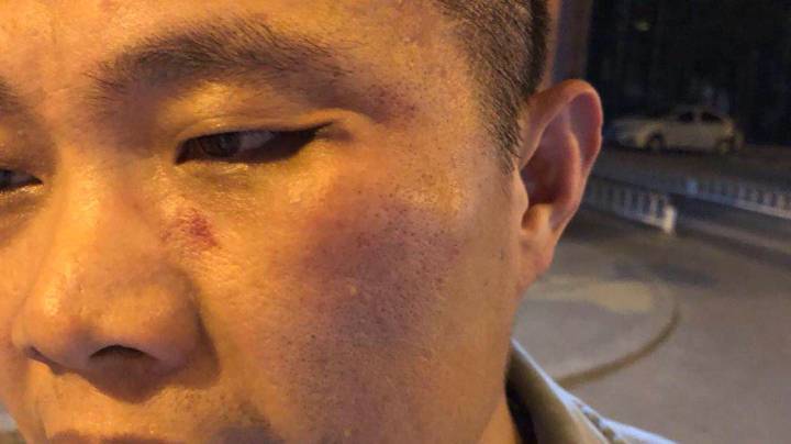 滴滴司機打投資人是怎么回事