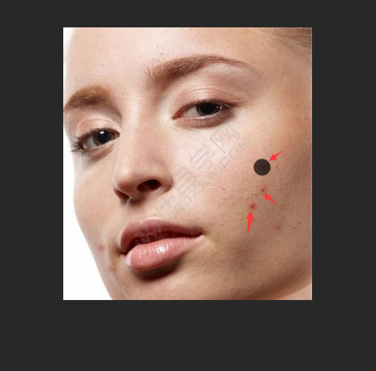 ps怎么把痘痘p沒