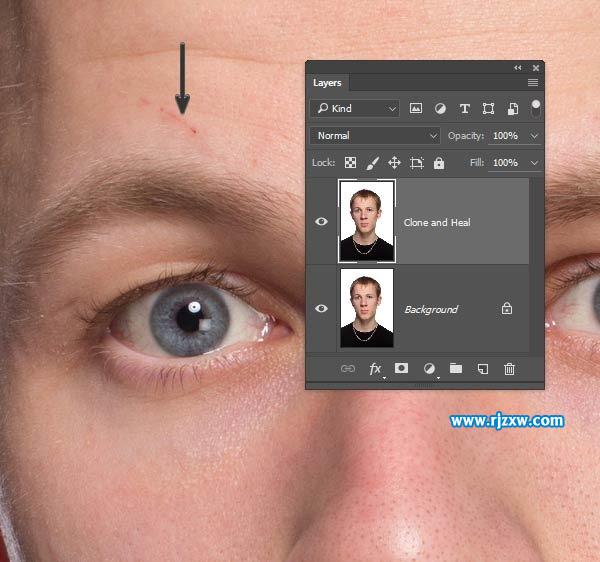 20歲男子一夜變成老頭